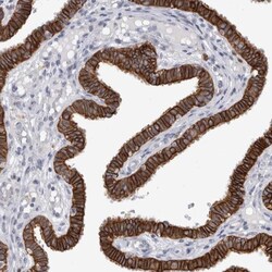 SLC20A2 Antibody, Novus Biologicals 0.1mL; Unlabeled:Antibodies, Polyclonal